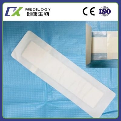Disposbale High Quality Wound Dressing Wound Dressing Hospital Use Wound Care