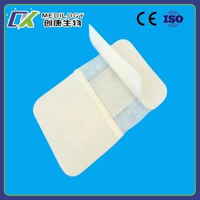 Medical Disposable Non-Woven Wound Dressing with Absorbent Pad, Self-Adhesive,