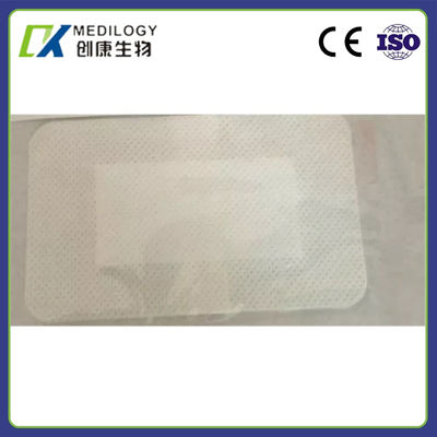 PU Transparent Membrane Dressing Transmeable Disposable Medical Consumables